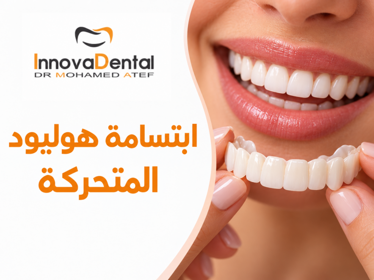 Hollywood Snap-On Smile: Your Instant Perfect Smile